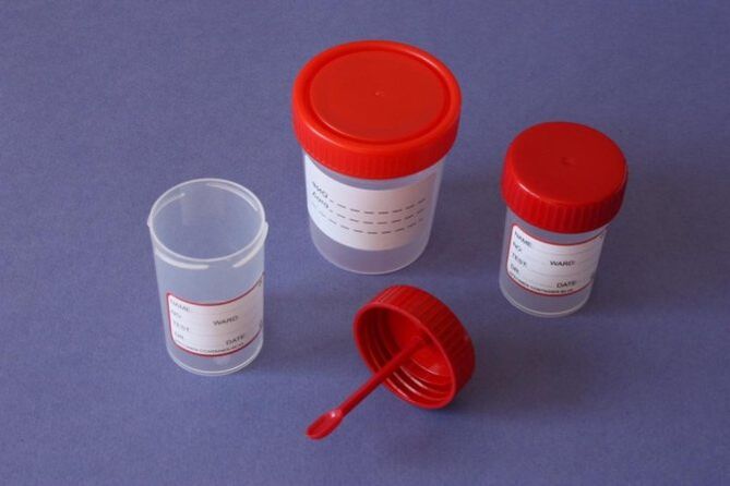 Parasites diagnostic methods in humans