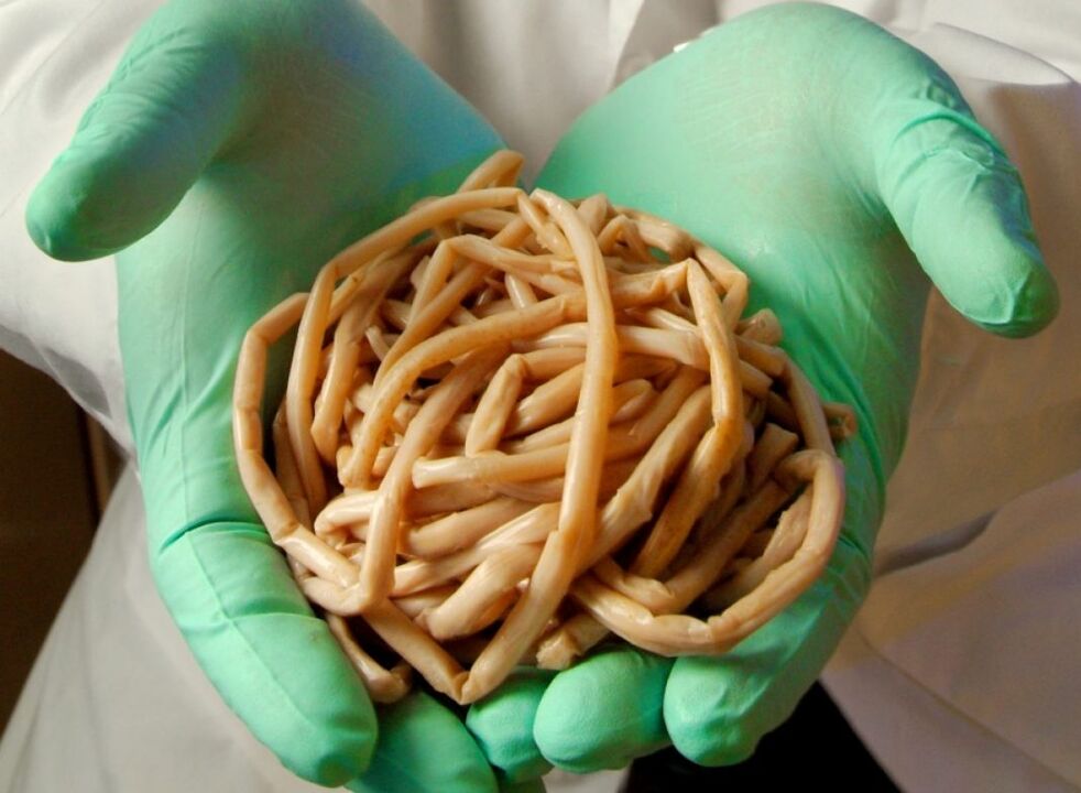 What parasites do humans have